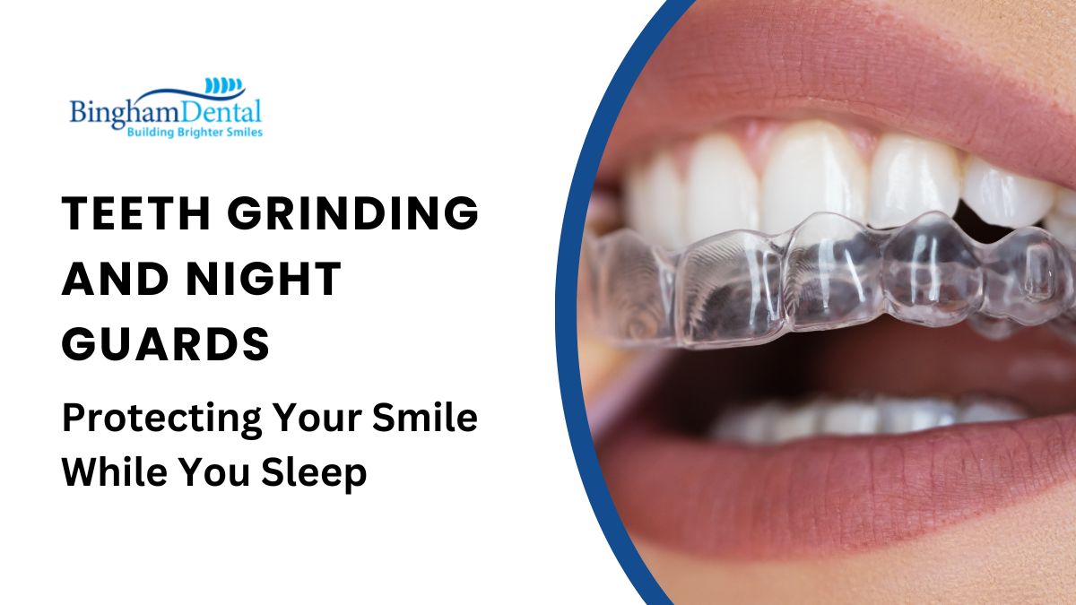Teeth Grinding and Night Guards