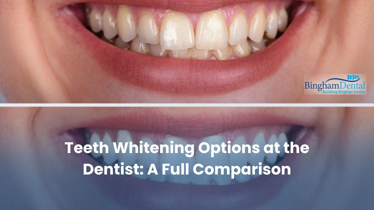 Teeth Whitening Options