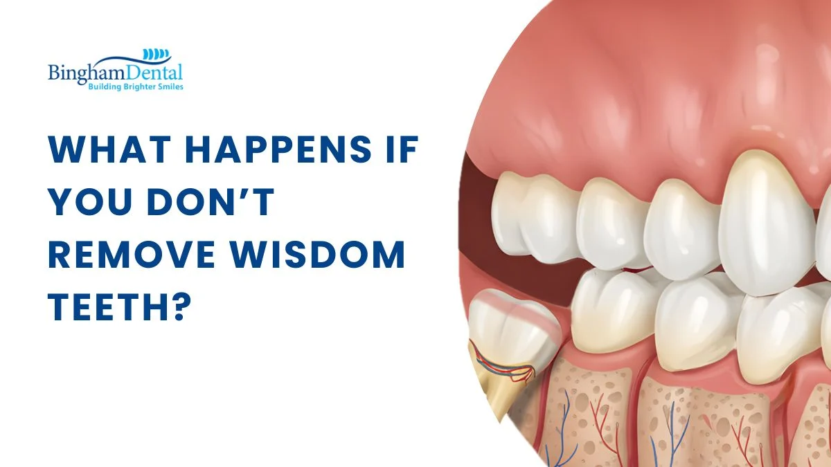 What Happens If You Don’t Remove Wisdom Teeth